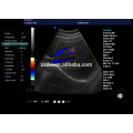 vaskulärer Doppler-Ultraschall &amp; OB / GNY Herzfarbdoppler